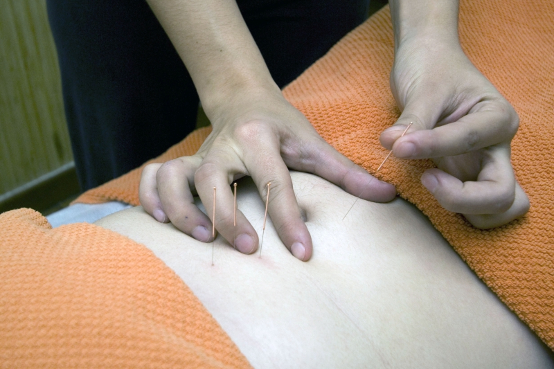 osteopathe-POURCIEUX-min_acupuncture-4175625